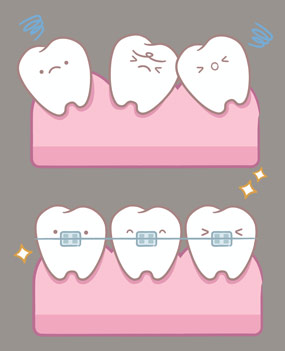 ortodoncija djece