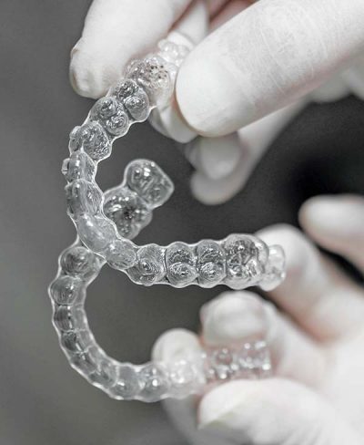 invisalign, nevidljiv aparat