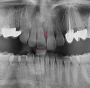parodontologija_1